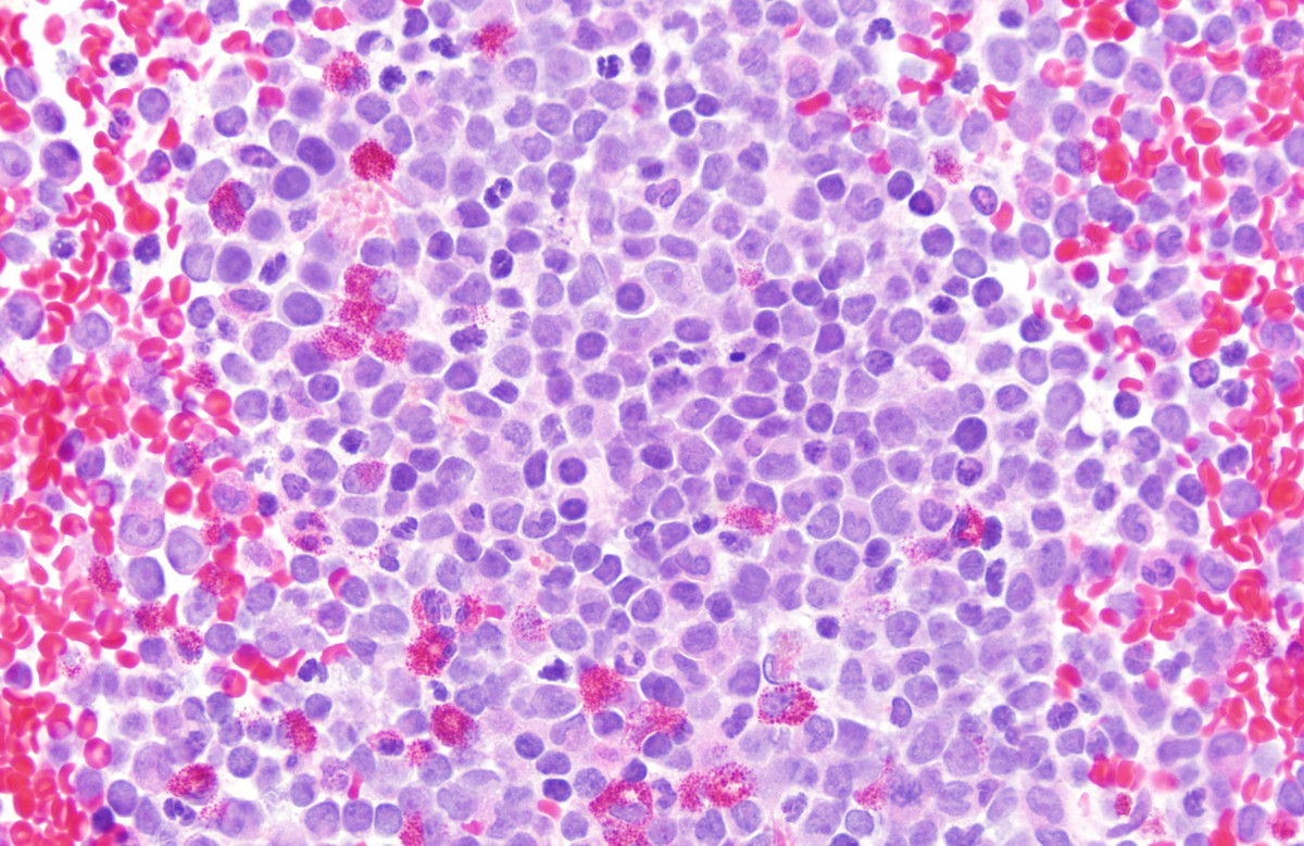 5. Clot section